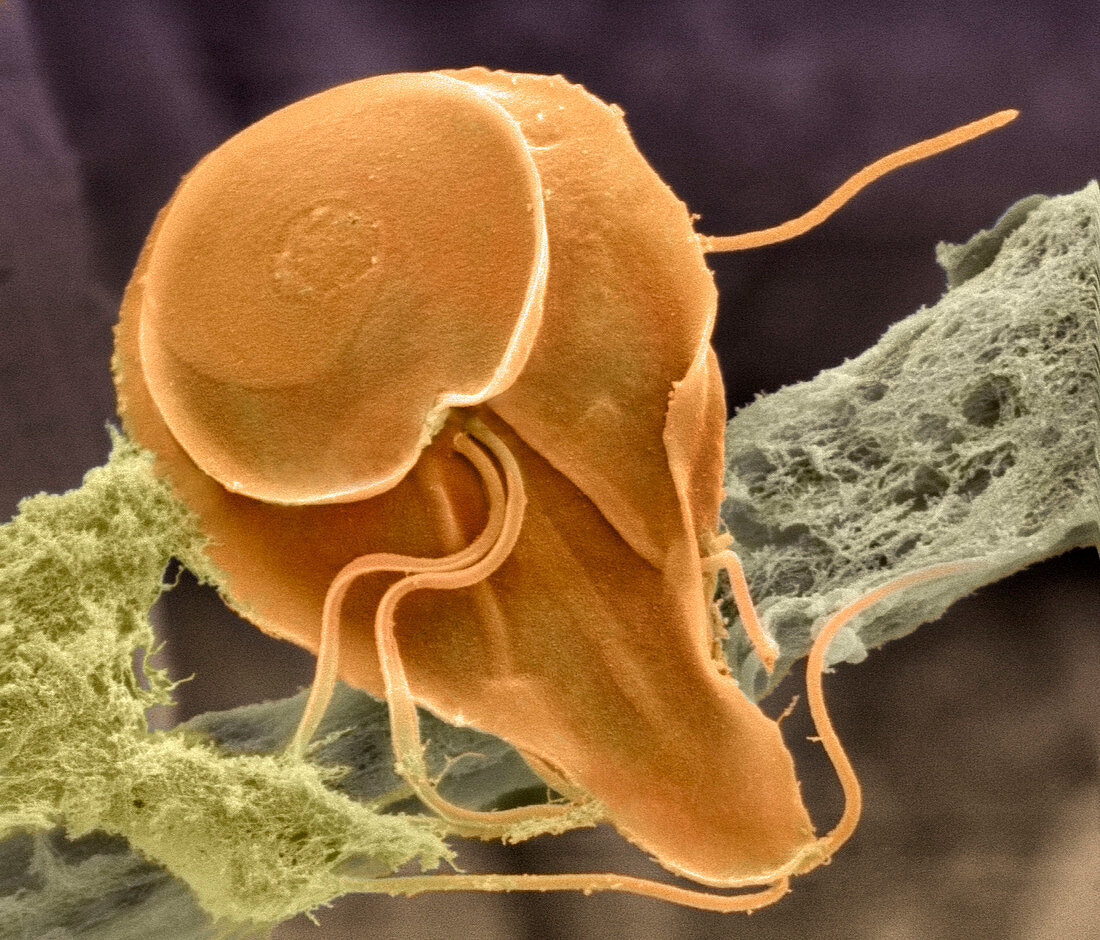 Giardia Lamblia Protozoan SEM Bild Kaufen Science Photo Library