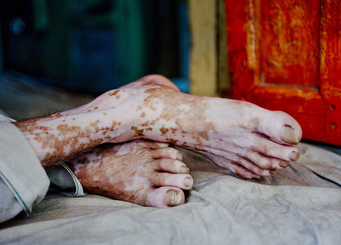 50 to 55 years, 50 to 60 years, 50-55 years, 50-60 years, Disorder, Feet, Fifties, Ghat, Ghats, India, Man, Orange, Portrait, Religion, Sitting, Skin, Strange, Varanasi, Vitiligo, F17-704595, agefotostock