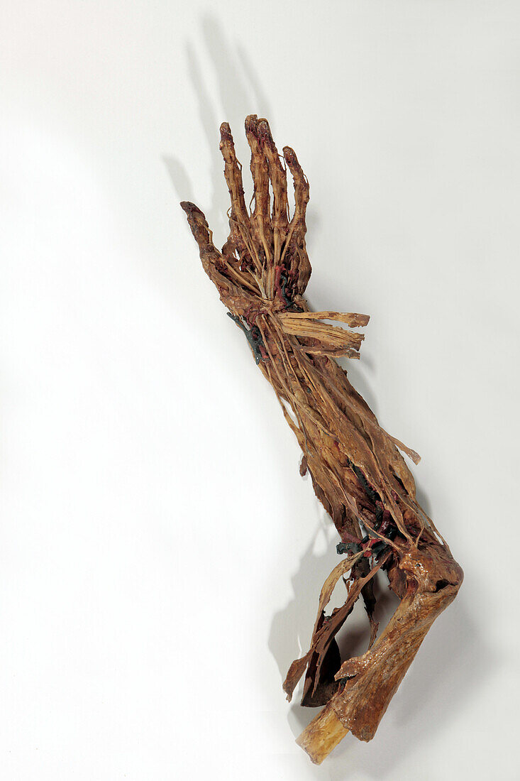 Human Arm, Ecorche By Honore Fragonard, Late 18Th Century, Fragonard Museum, National Veterinary School Of Alfort, Maisons-Alfort, Val-De-Marne (94), France