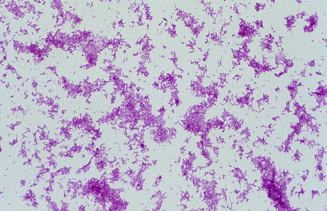 Salmonella typhi Bactery of typhoid fever Gram