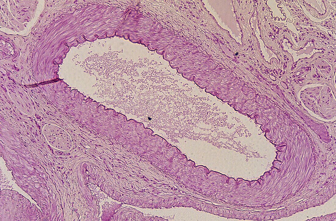 Venule Blood vessel Circulatory tissue 35x