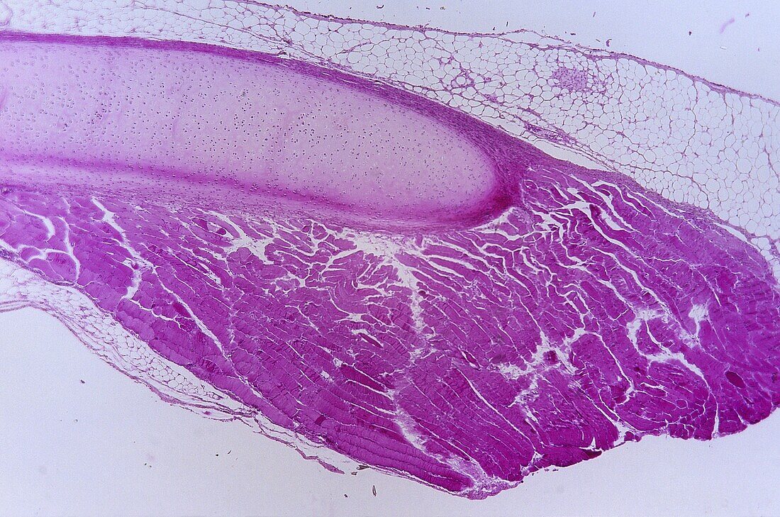 Hyaline cartilage Cartilaginous tissue 9x