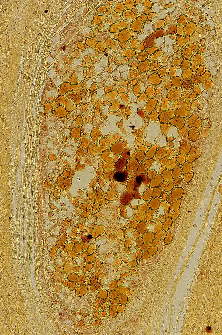 Adypocites Adipose tissue 35x