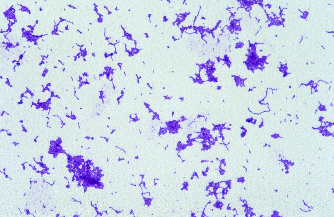 Streptococcus pyogenes bacterium