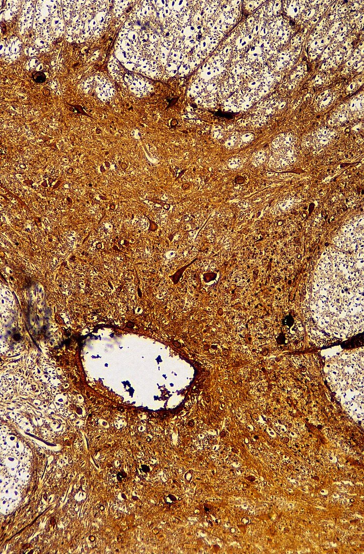 Multipolar neuron of the spinal cord Nervous tissue