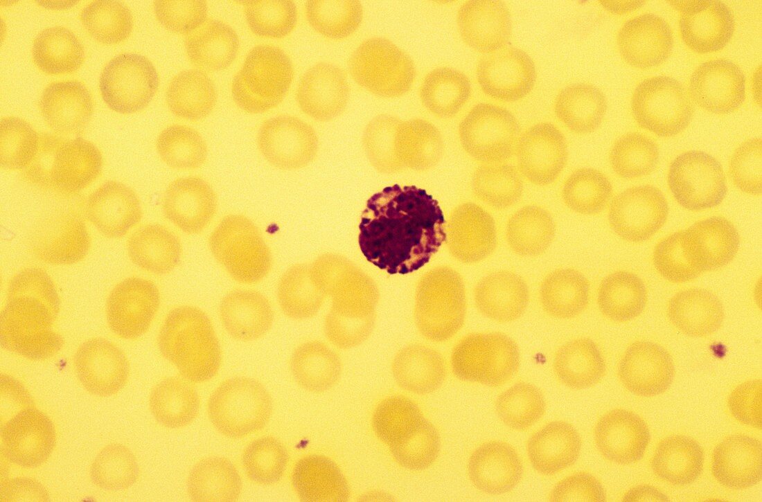 basophil white blood cell