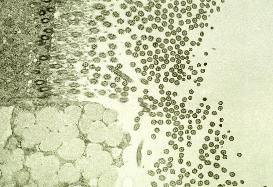 Epithelial trachea