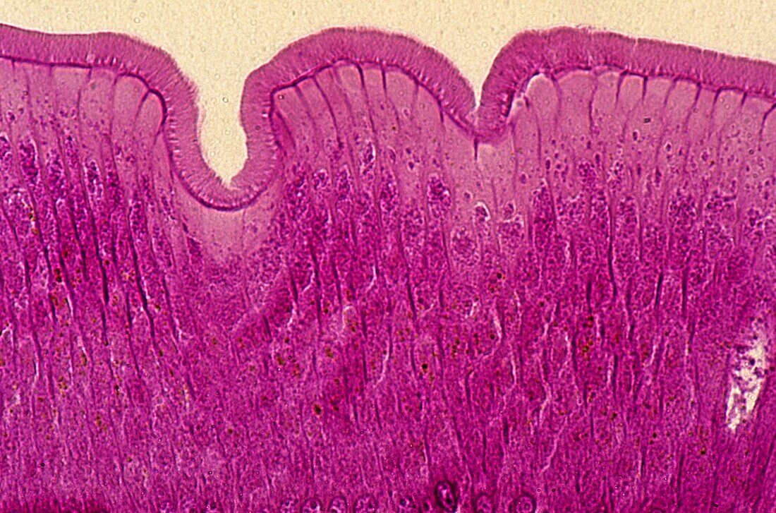 Epithelial cells of intestine of Ascaris 140x