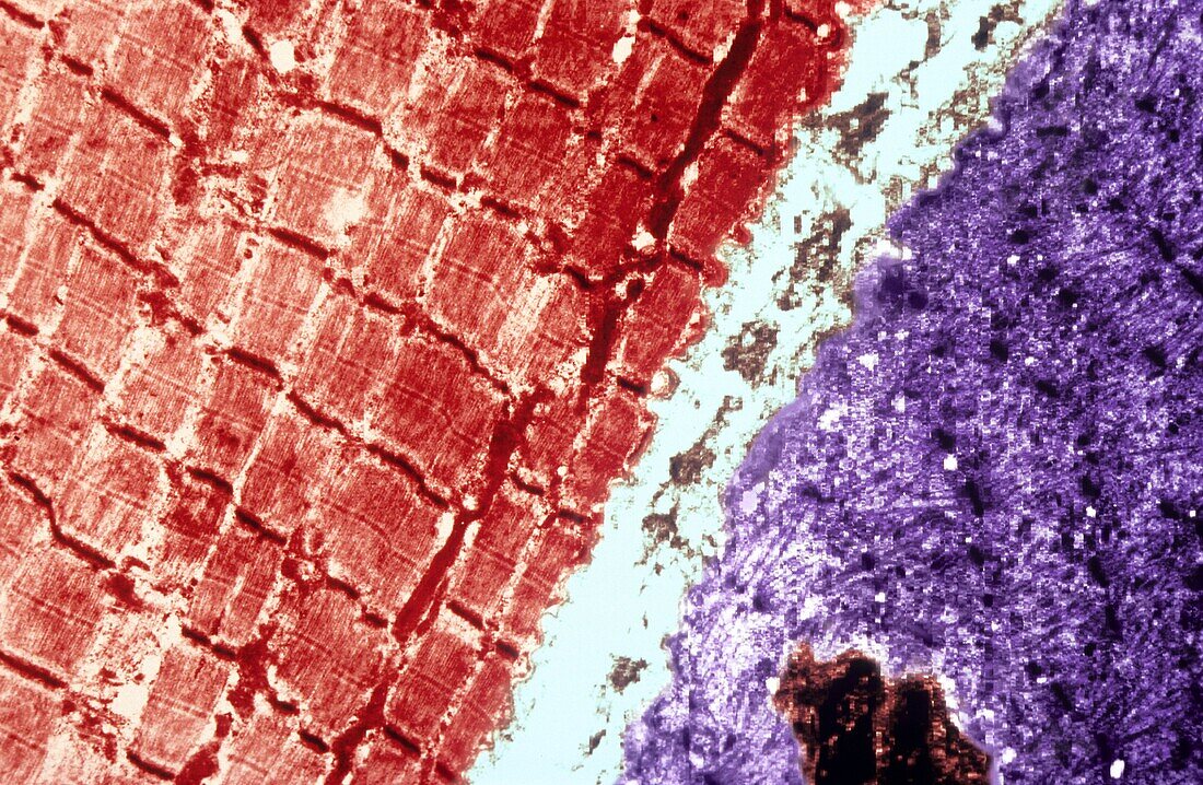 Electron micrograph of striated muscle tissue