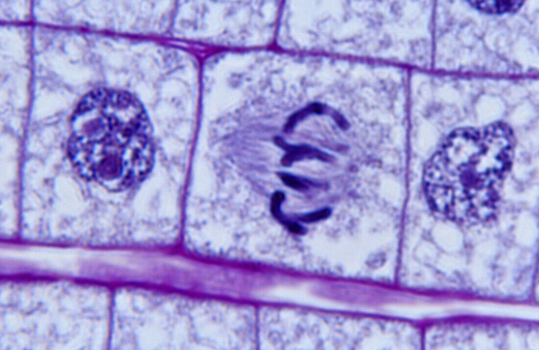 Onion mitosis root tip