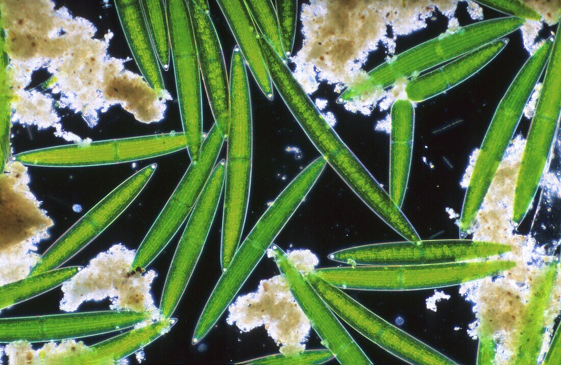 Closterium Chlorophyta Algae Optic microscopy