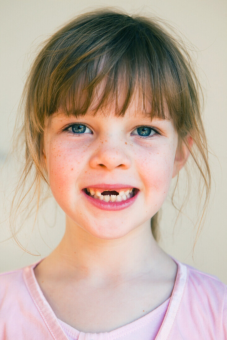 Young girl with missing front teeth, gold coast queensland australia