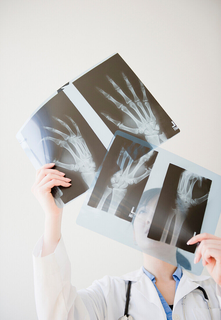 Korean doctor looking at x-rays of hand bones, Jersey City, New Jersey, USA
