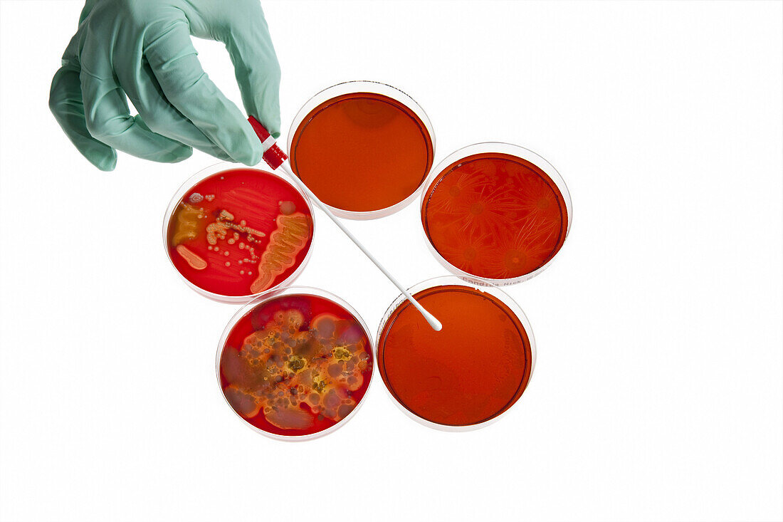 A lab technician using a cotton swab on a Petri dish with a bacteria culture, close-up of hand