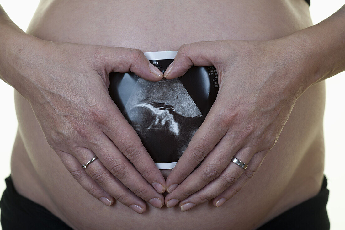 A pregnant woman holding an ultrasound printout against her belly