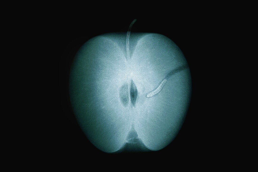 X-ray of an apple with maggot (photomontage)