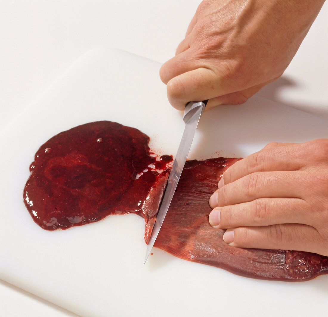 Removing spleen from liver, step 2