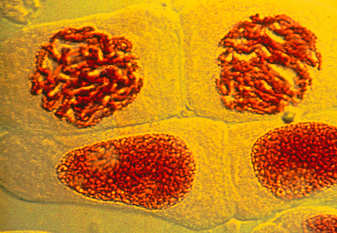 Interphase of mitosis in bluebell cells