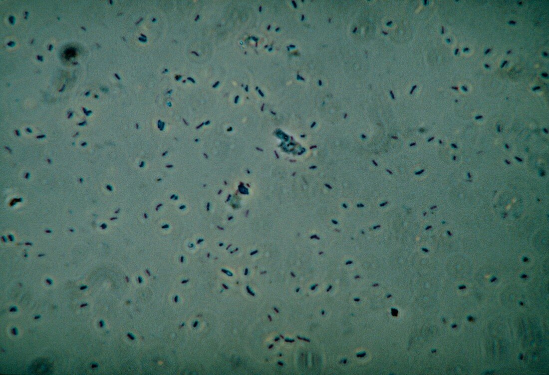 LM of Mycobacterium tuberculosis bacteria