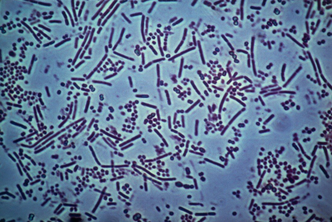 LM of bacteria taken from the human mouth