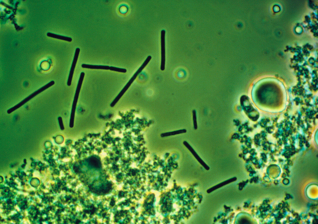 LM of Lactobacillus bulgaricus bacteria