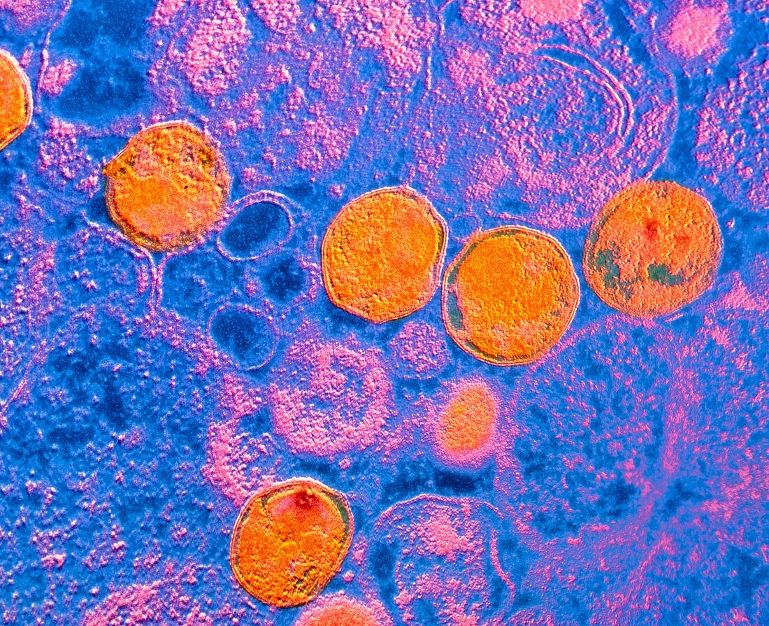 TEM of Chlamydia sp. spherical bacteria