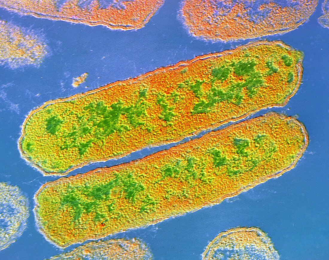 Haemophilus influenzae bacteria