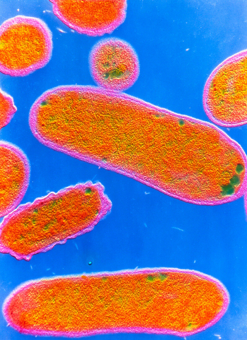 Coloured TEM of Salmonella typhi bacteria