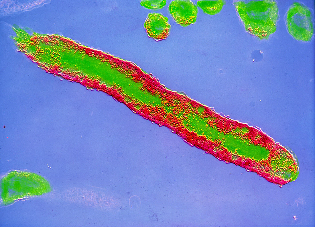 Coloured TEM of Vibrio cholerae bacterium