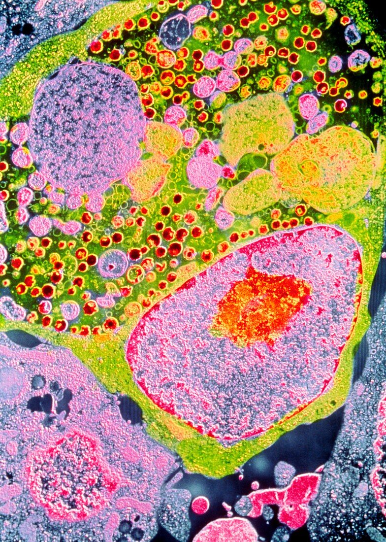 Coloured TEM of Chlamydia sp. bacteria