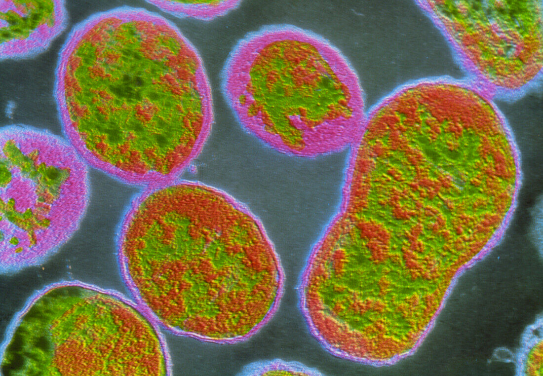 f/Colour TEM of Brucella abortus bacteria