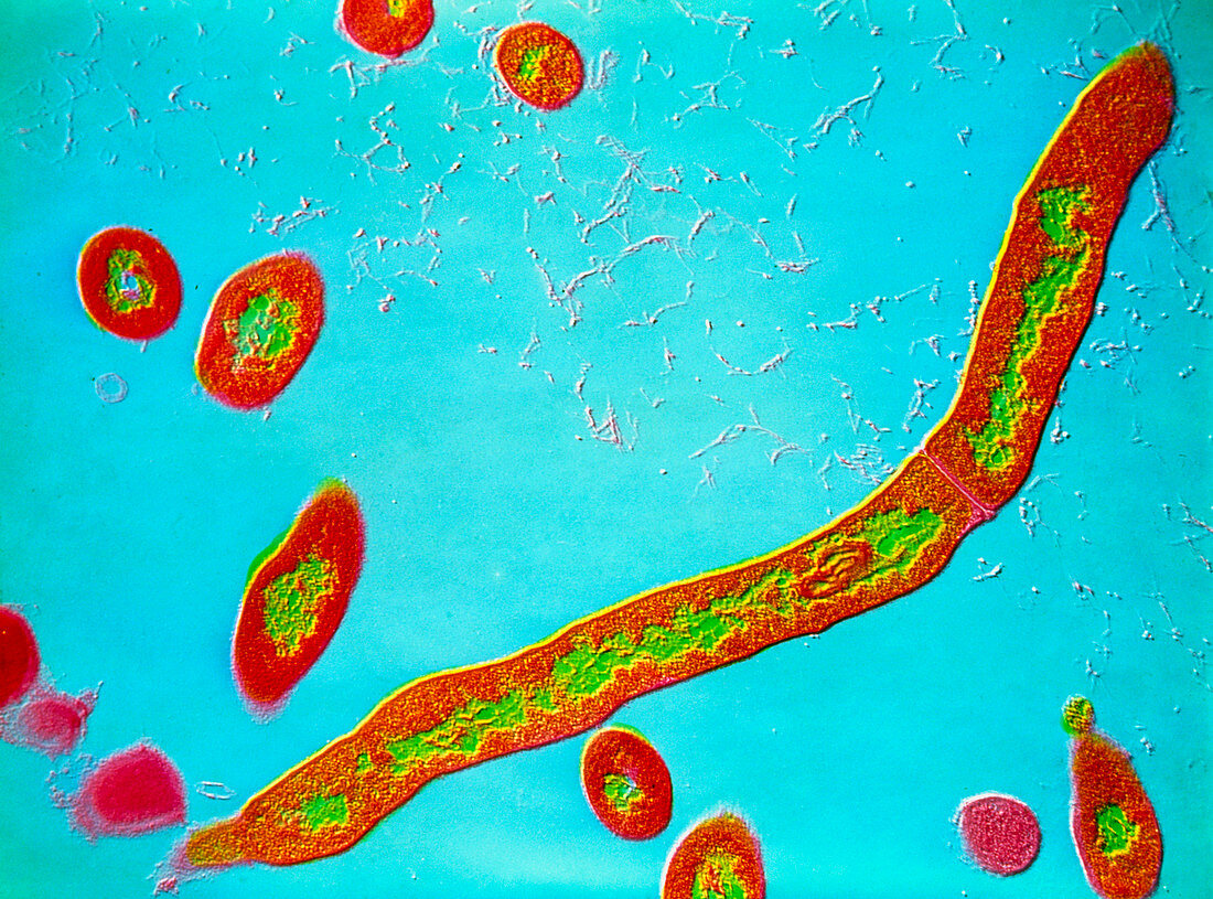 Coloured TEM of Nocardia sp. bacteria