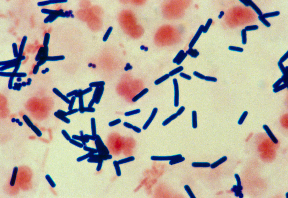 Clostridium perfringens bacteria from wound