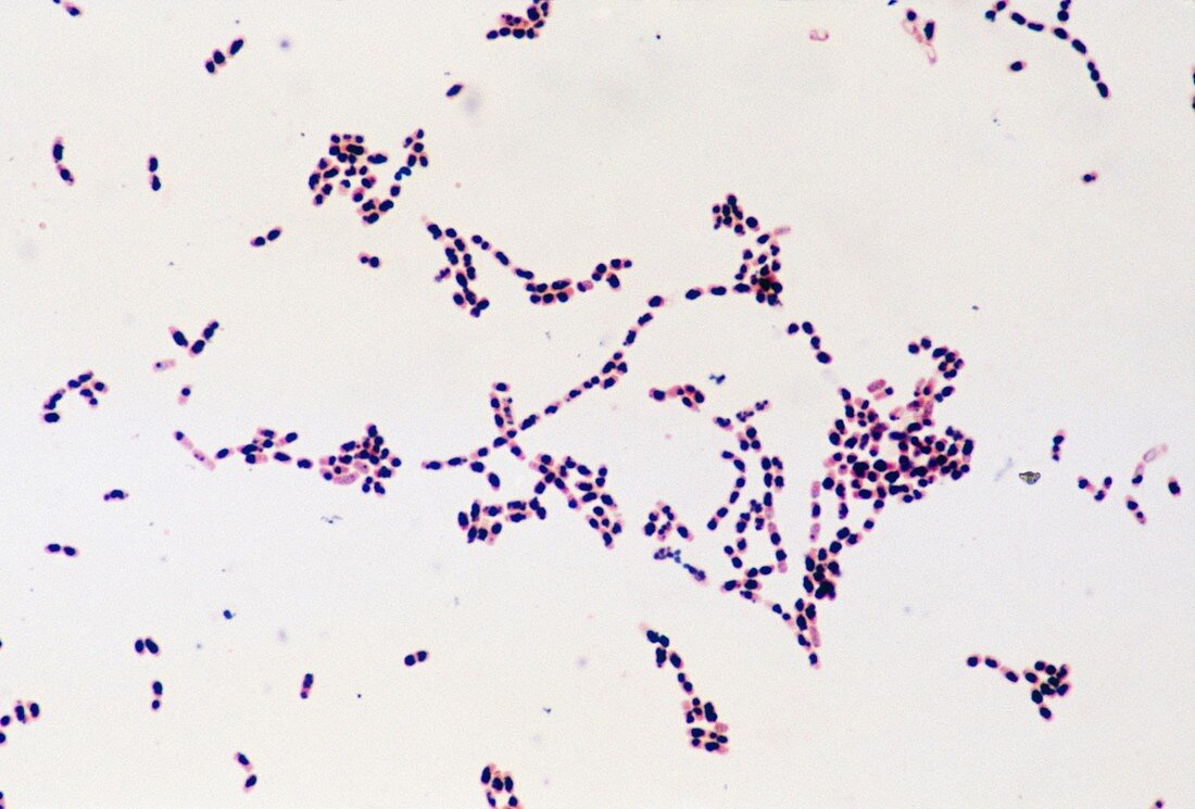 LM of colony of Bacillus cereus bacteria