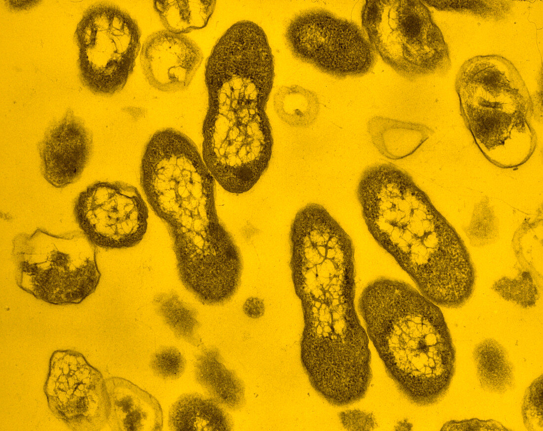 TEM of Bordetella pertussis bacterium