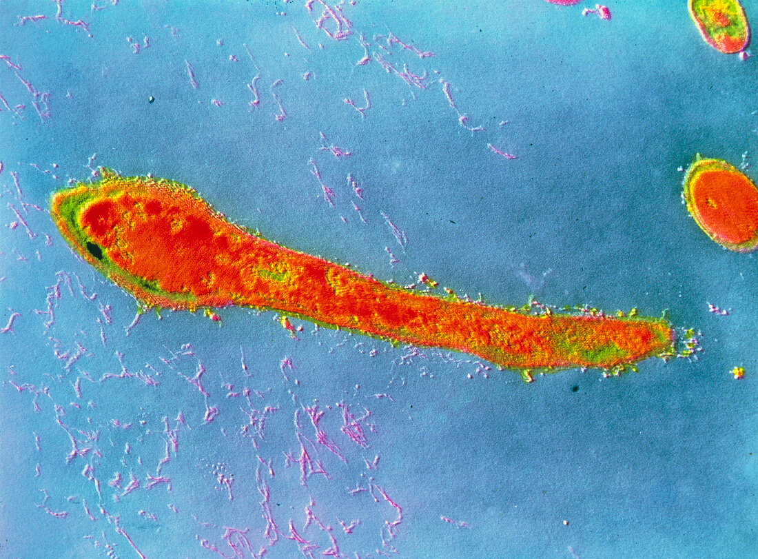 Actinomyces israelii bacterium