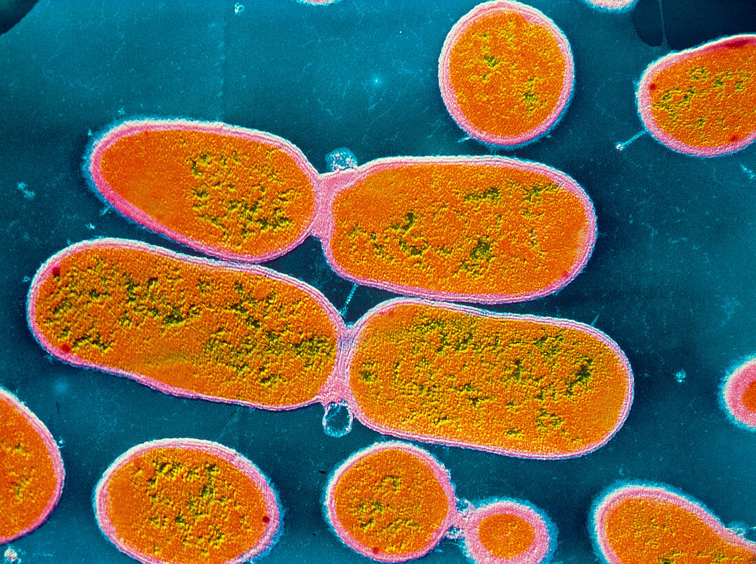 TEM of Shigella sp. bacteria