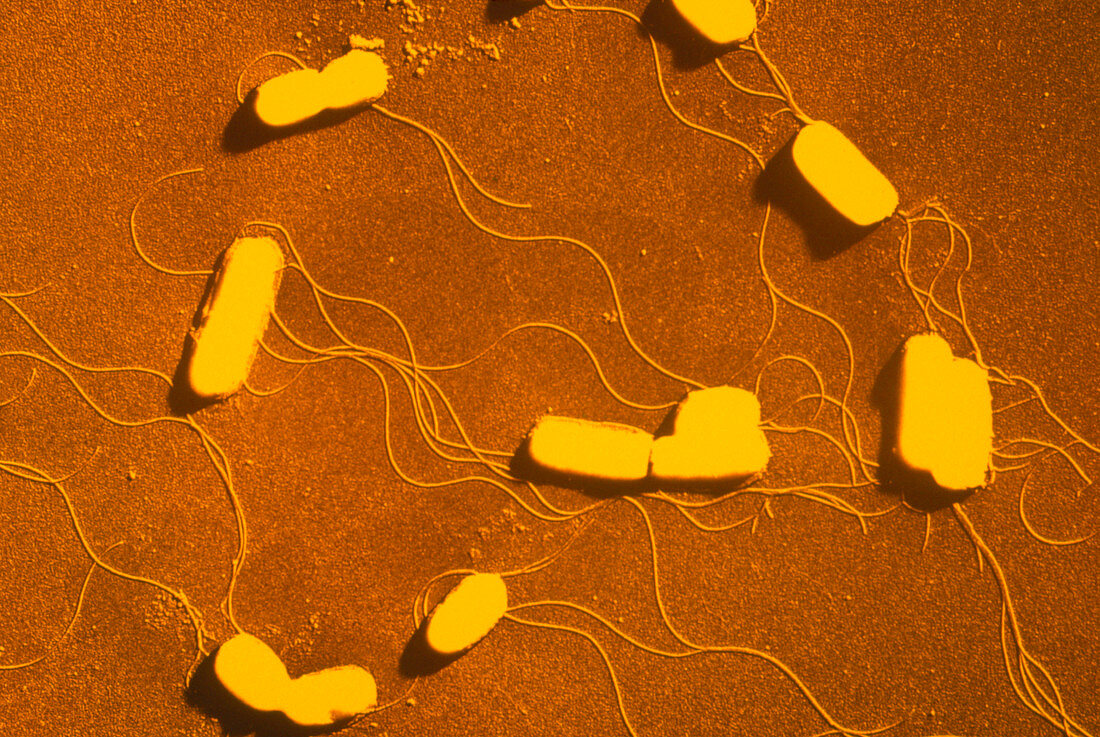 Colony of Listeria monocytogenes bacteria