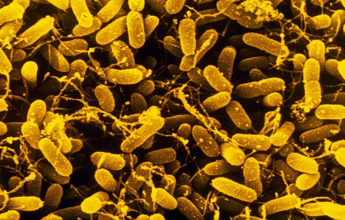 SEM of a colony of Salmonella typhimurium