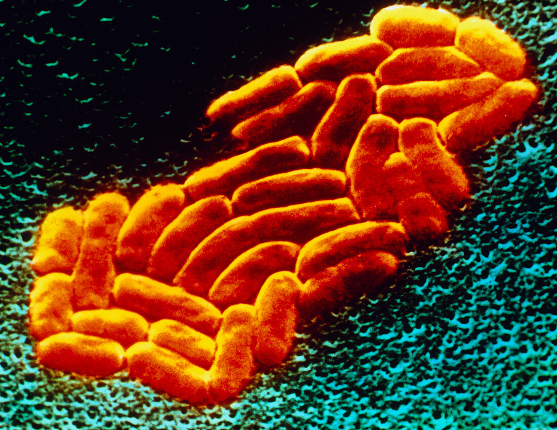 SEM of a colony of Klebsiella pneumonia