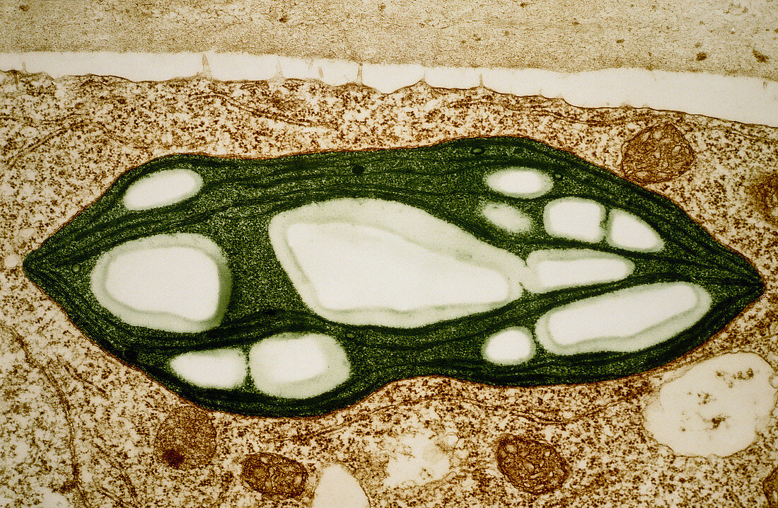 TEM of a chloroplast from a moss