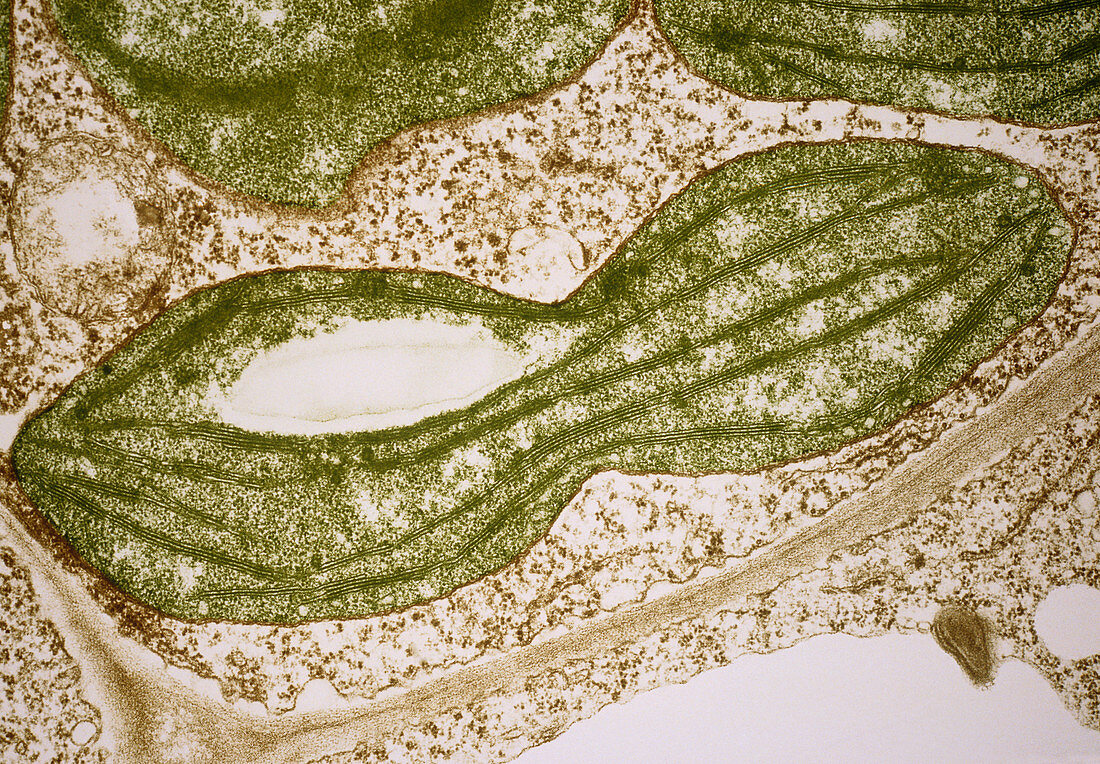 Dividing chloroplast in a pea leaf