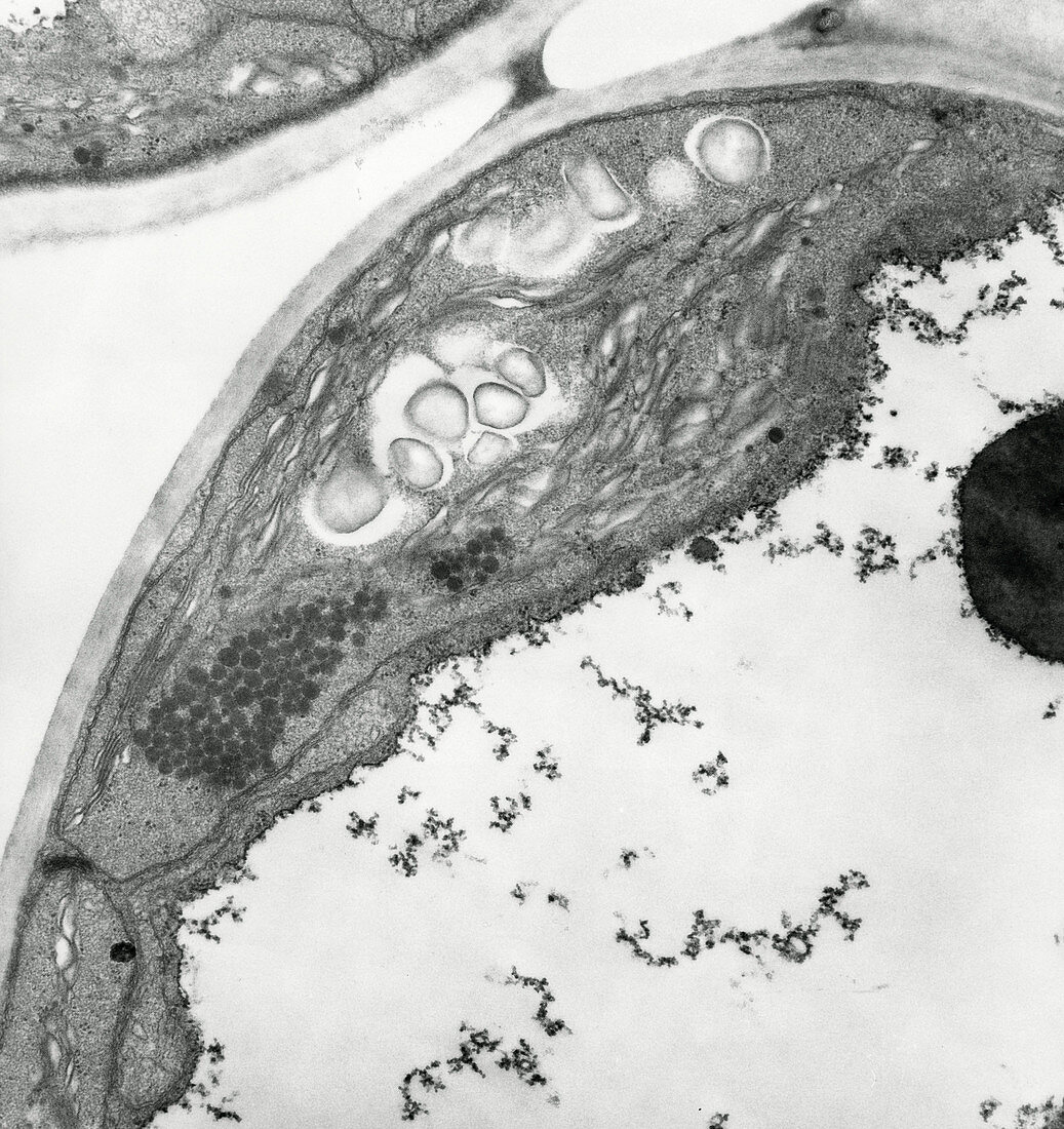 TEM of a chloroplast in a leaf cell