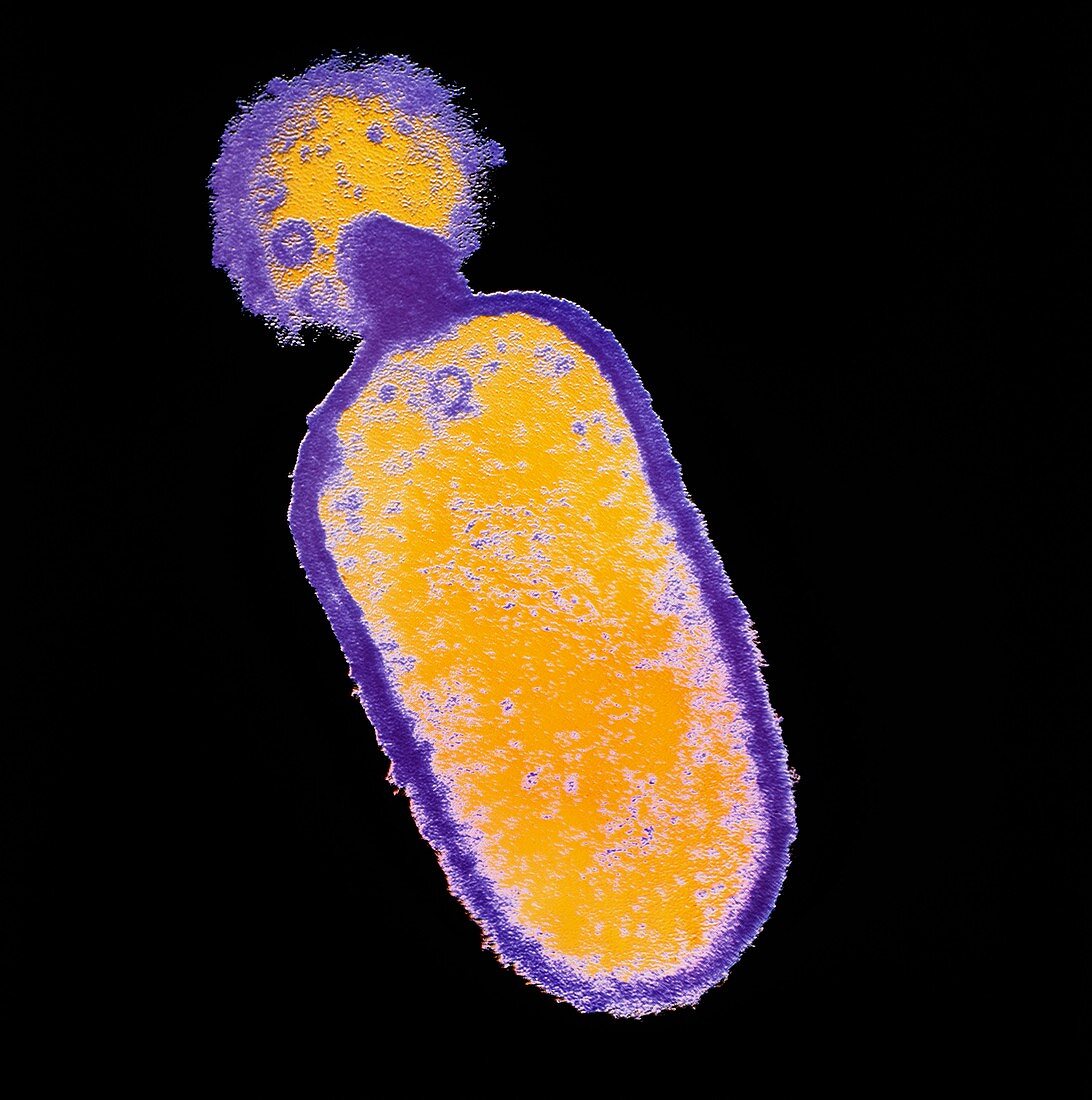 Listeria monocytogenes bacterium