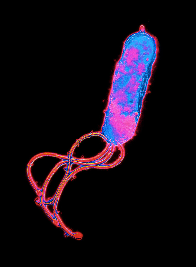 TEM of Helicobacter pylori bacterium
