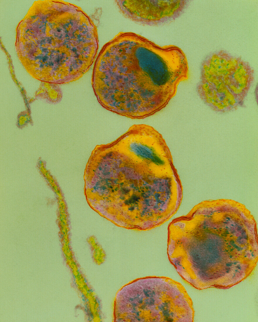 Chlamydia psittaci bacteria