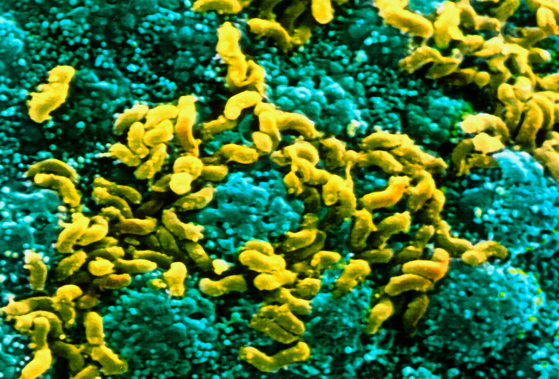 Helicobacter pylori bacteria on stomach