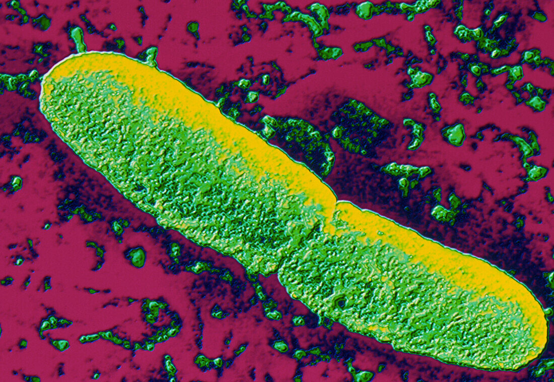 Yersinia pestis (plague) bacteria