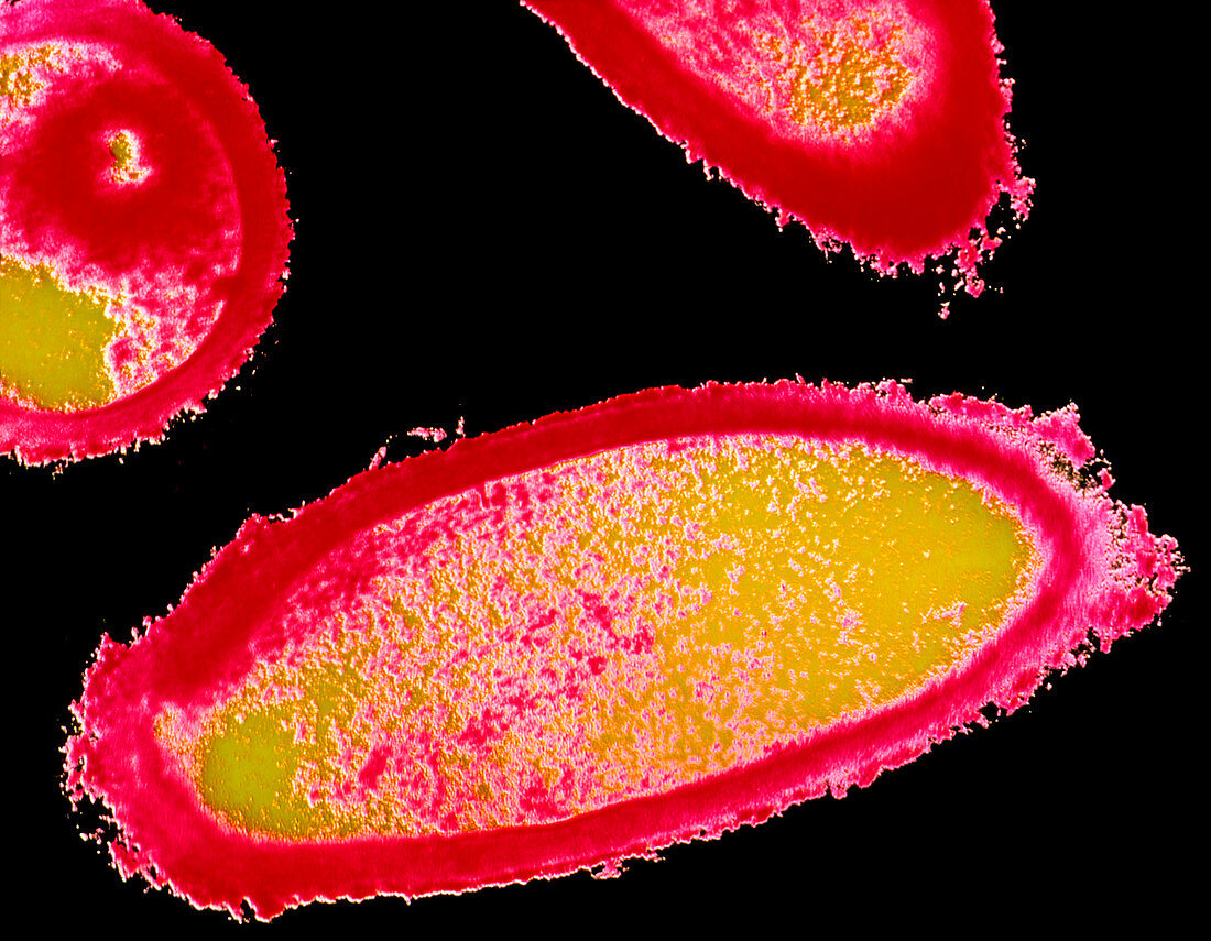 Coloured TEM of Lactobacillus acidophilus