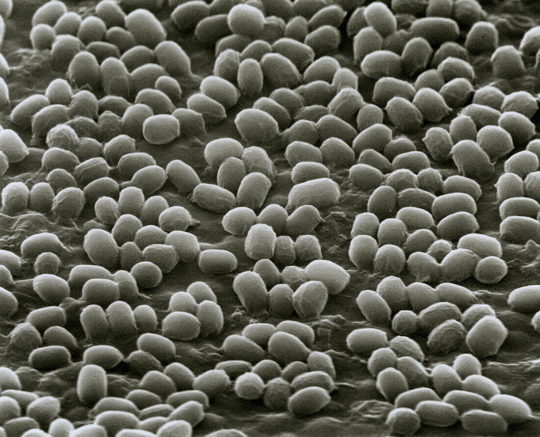 Spores of Bacillus anthracis bacteria